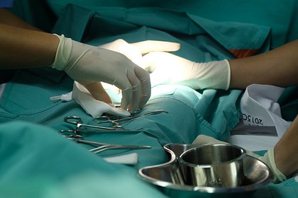 Сброшенной отцом с четвертого этажа девочке потребовалось полностью собирать череп