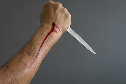 Россиянин спас девушку от избиения и был ранен ножом